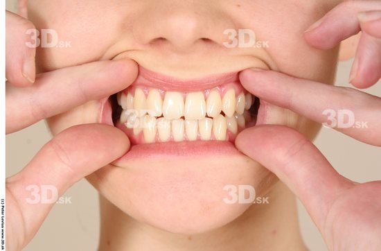 Teeth Woman White Slim