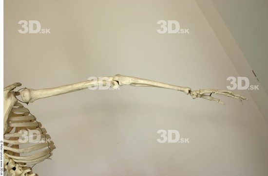 Arm Skeleton