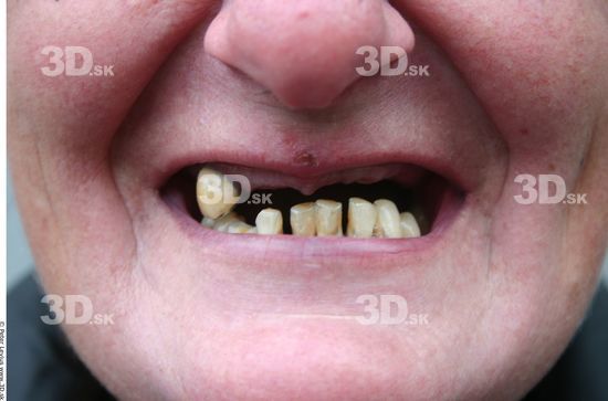 Teeth Woman White Slim