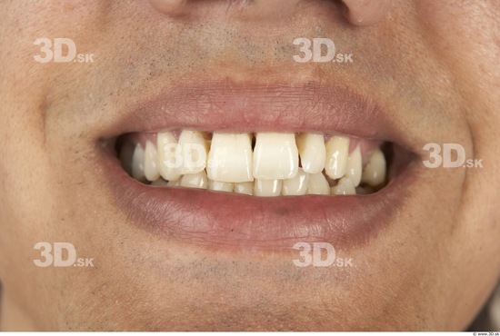 Teeth Man White Nude Slim