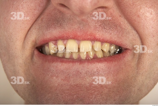 Teeth Man White Nude Slim