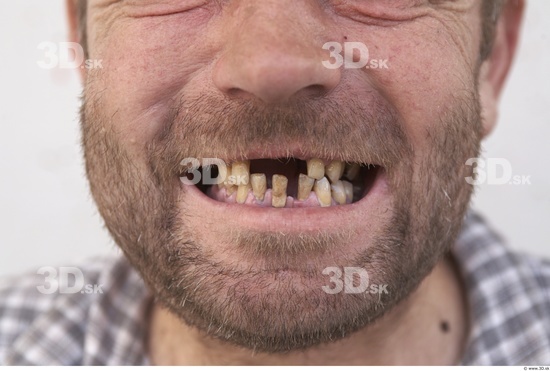 Teeth Man White Casual Average