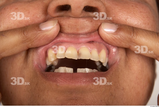 Teeth Woman White Nude Average