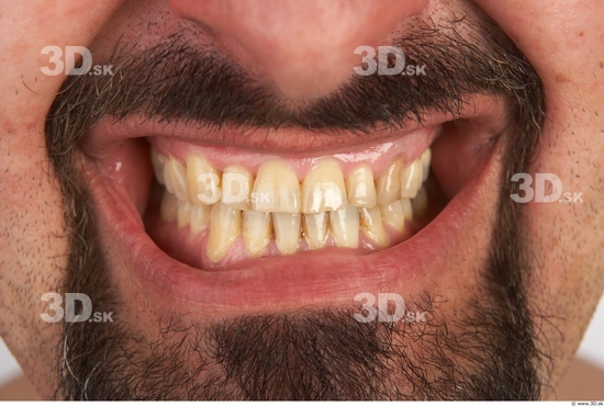 Teeth Man White Nude Average