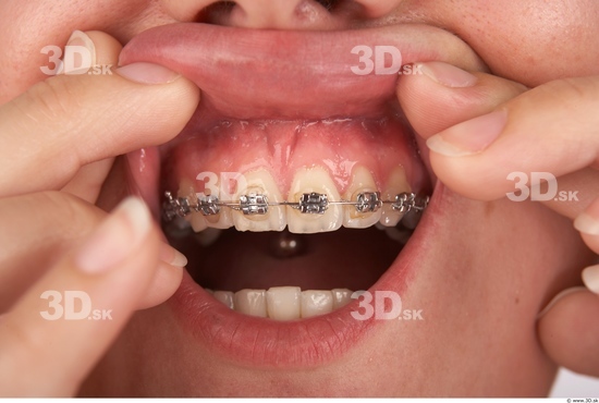 Whole Body Teeth Woman Braces Slim Studio photo references