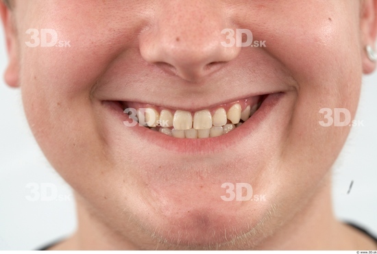 Teeth Man White Overweight