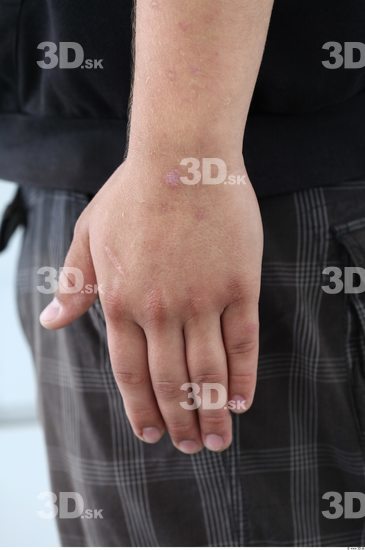 Hand Head Man Casual Chubby Overweight Street photo references