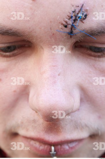 Nose Man White Scar Average