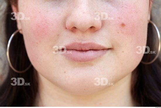 Mouth Woman White Birthmarks Average