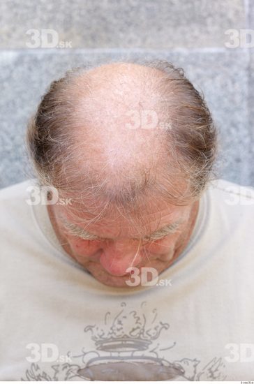 Hair Man White Overweight Bald