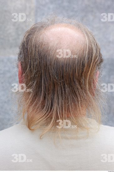 Hair Man White Overweight Bald