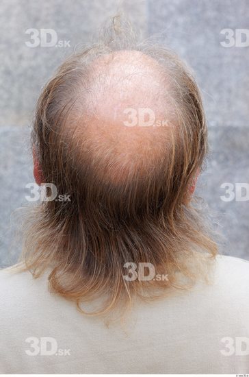 Hair Man White Overweight Bald