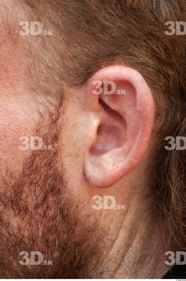Ear Man White Underweight Bearded