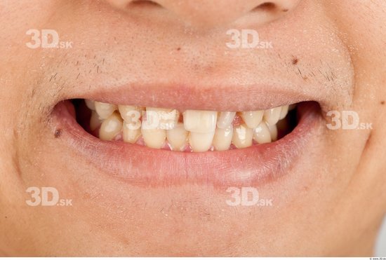 Teeth Asian Studio photo references