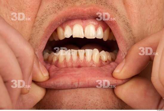 Teeth Athletic Studio photo references