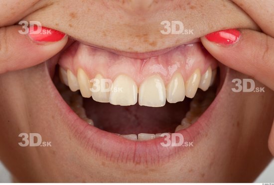 Teeth Slim Studio photo references