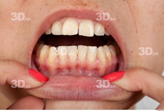 Teeth Slim Studio photo references