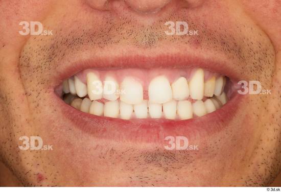 Teeth Man White Slim Studio photo references