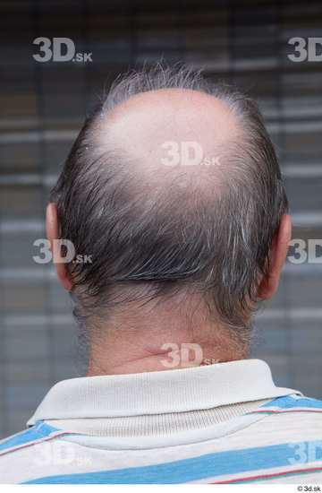 Head Hair Man White Casual Average Bald Street photo references