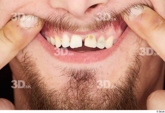 Teeth Man White Slim Studio photo references