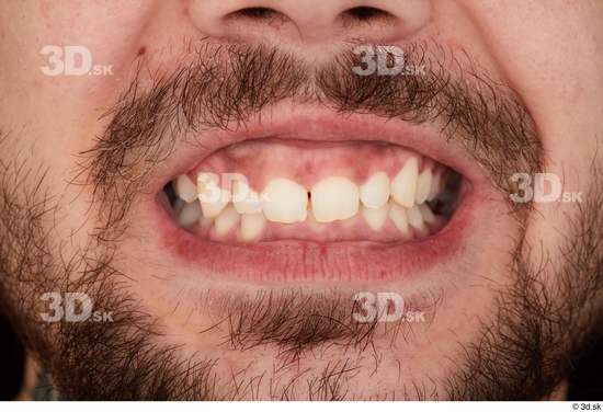 Teeth Man White Slim Studio photo references