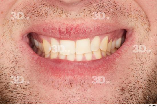 Teeth Man White Average Studio photo references