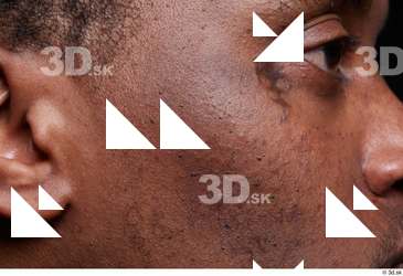 HD Face Skin Demarien Smith cheek ear face scar skin…