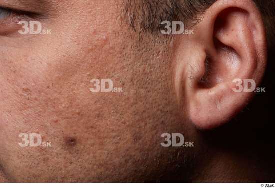 Face Cheek Ear Hair Skin Man Birthmarks Chubby Studio photo references