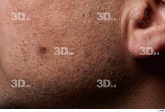 Face Cheek Ear Skin Man Birthmarks Chubby Studio photo references