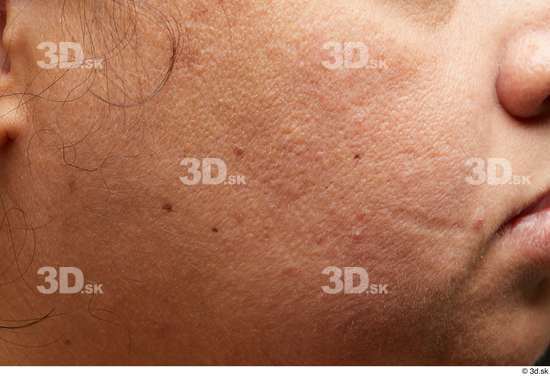 Face Cheek Skin Woman Scar Chubby Studio photo references