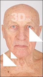 Head Scan # 1