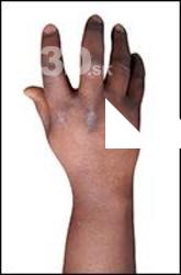 Igbinovia Retopo Hand Scan