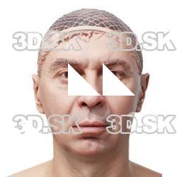 Reece Burke Raw Head Scan