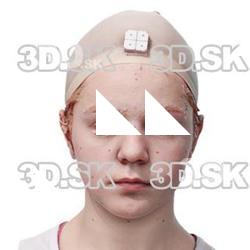 Sariyah Lawson Raw Head Scan