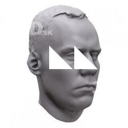 Mirec Base Scan Head