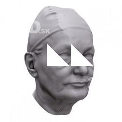 Vilma Base Scan Head