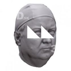 Andreas Base Scan Head