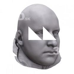 Tomas Base Scan Head