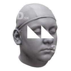 Vojta Base Scan Head