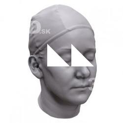 Aria Base Scan Head