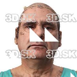 Daifallah Ahsan Raw Head Scan