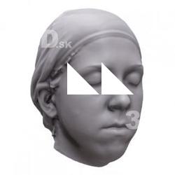 Base Scan Katerine's Head
