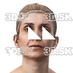 Rafeeqa Dia Raw Head Scan
