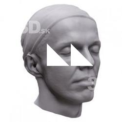 Vojta Base Head Scan