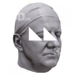 Frederick Base Head Scan