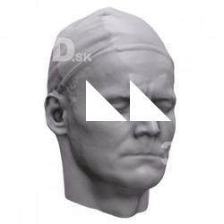 Martin Base Head Scan