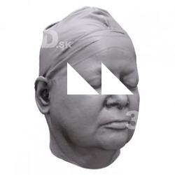 Hana Base Head Scan