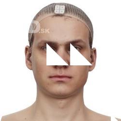 Brett Raw Head Scan