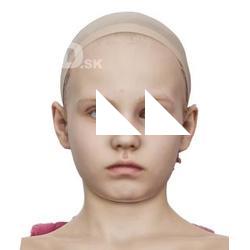 Novel Raw Head Scan