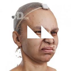 Rihanni Howard Raw Morph Scan - 18 Nasolabial Furrow Deepener